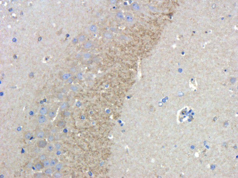 CHRNA7 Rabbit Polyclonal Antibody