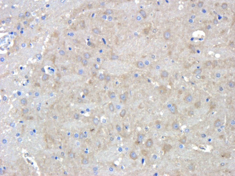 CHRNA7 Rabbit Polyclonal Antibody