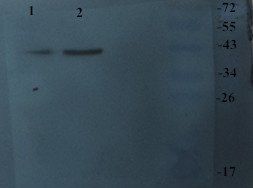 CHRNA7 Rabbit Polyclonal Antibody