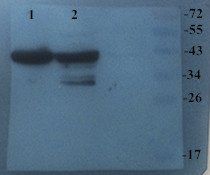 CHRNA7 Rabbit Polyclonal Antibody