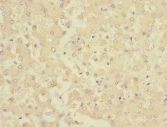 CHRNE Antibody