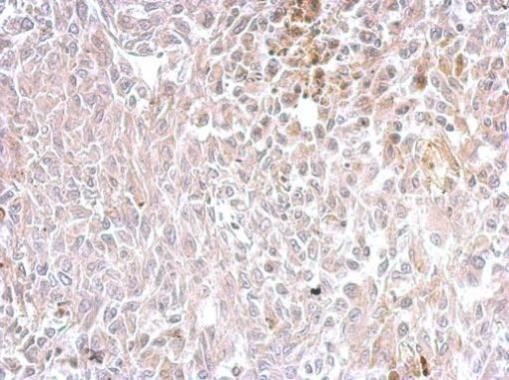 Chromogranin C Rabbit Polyclonal Antibody