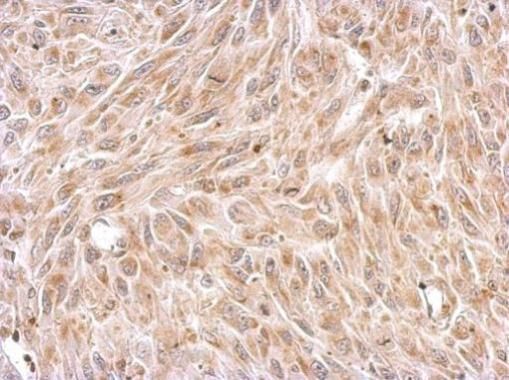 Chromogranin C Rabbit Polyclonal Antibody