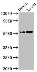 CHST9 Antibody