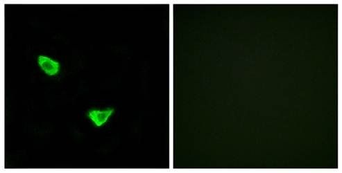 CHSY2 Antibody