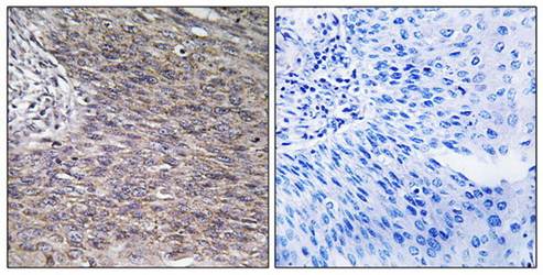 CHSY2 Antibody