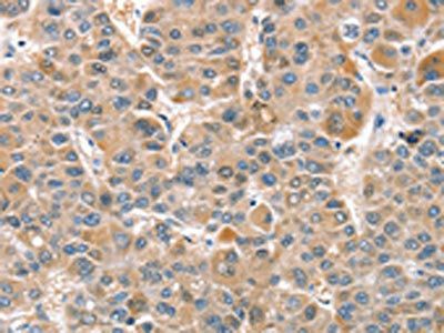 CIAPIN1 Antibody