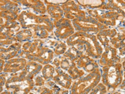 CIB1 Antibody