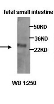 CIDEB Rabbit Polyclonal Antibody