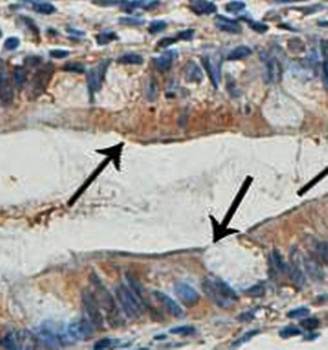 CIDEB Rabbit Polyclonal Antibody