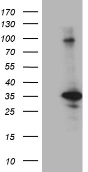 CINP Antibody