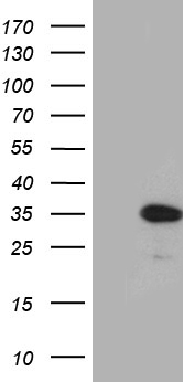 CINP Antibody
