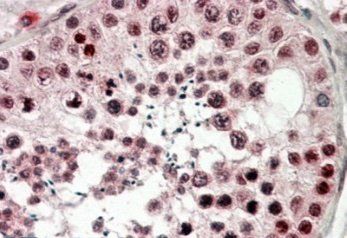 CIRBP (aa 161-172) Antibody