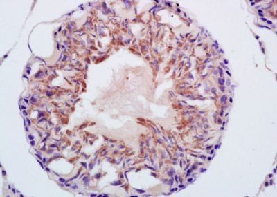 CITED1 Rabbit Polyclonal Antibody