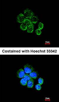 Citrate synthetase antibody