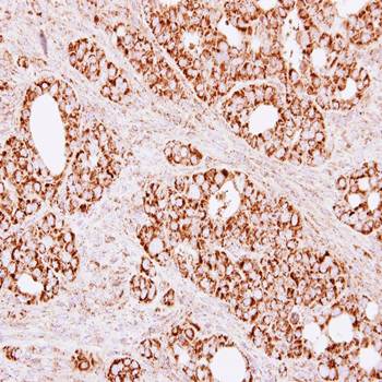 Citrate synthetase antibody