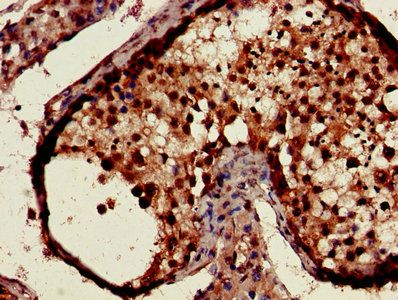 CSNK1A1 Antibody