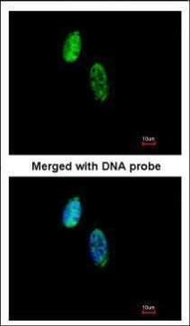 CKS2 Rabbit Polyclonal Antibody
