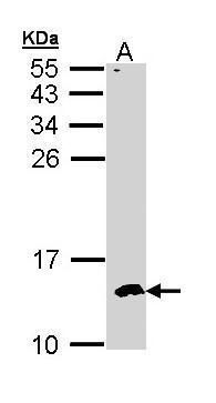 CKS2 Rabbit Polyclonal Antibody