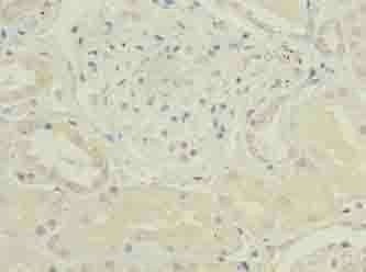 CKS2 Antibody