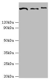CLTCL1 Antibody