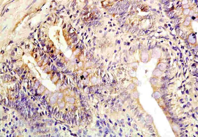 Claudin 4 Rabbit Polyclonal Antibody