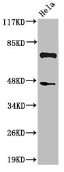 C1S Antibody