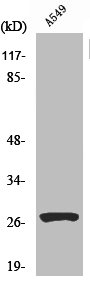 CTSD Antibody
