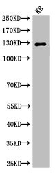 NOTCH2 Antibody