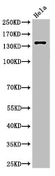 SPTAN1 Antibody