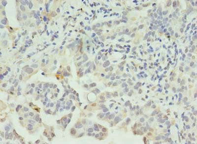 CLEC1A Antibody