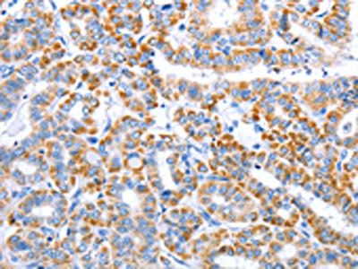 CLEC1B Antibody