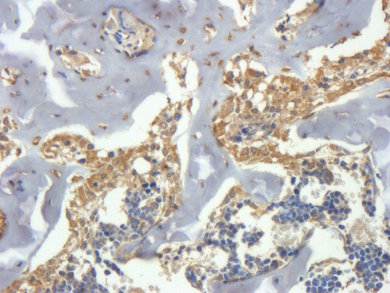 CLEC1B Rabbit Polyclonal Antibody