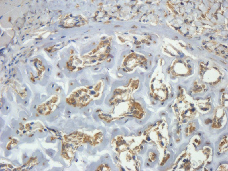 CLEC1B Rabbit Polyclonal Antibody