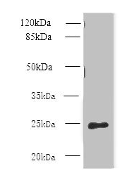 CLEC4E Antibody