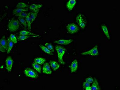 CLEC7A Antibody
