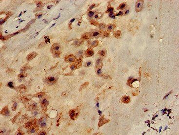 CLEC7A Antibody