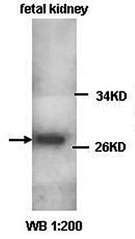 CLIC1 Rabbit Polyclonal Antibody