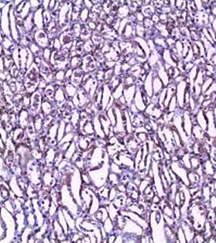 CLIC1 Rabbit Polyclonal Antibody