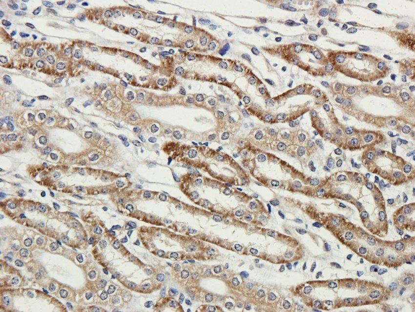 CLIC4 Rabbit Polyclonal Antibody