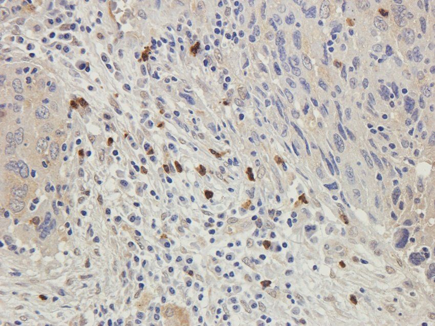 CLIC4 Rabbit Polyclonal Antibody