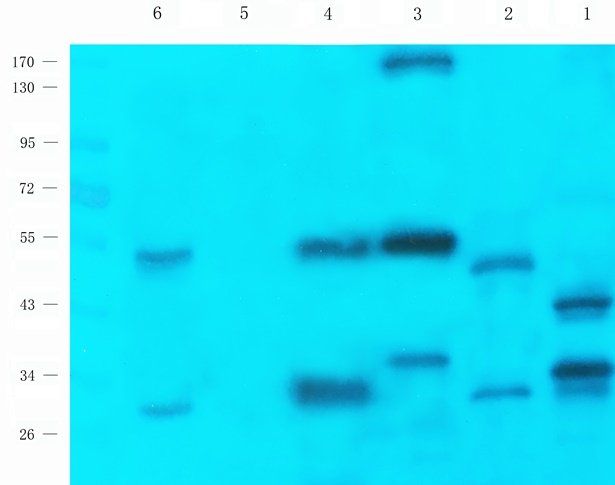 CLIC4 Rabbit Polyclonal Antibody