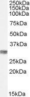 CLIC4 Antibody