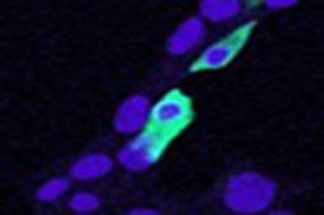 CLIC4 Antibody