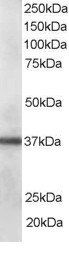 Goat anti-CLIM1 / PDLIM1 Antibody