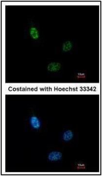 CLP1 Rabbit Polyclonal Antibody
