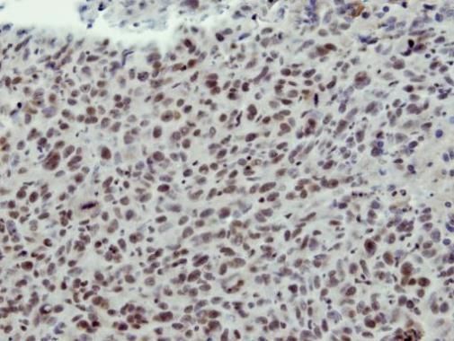 CLP1 Rabbit Polyclonal Antibody