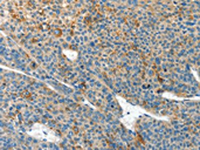 CLPTM1L Antibody