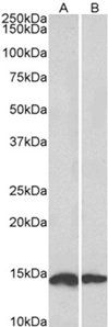 NDUFS6 Antibody