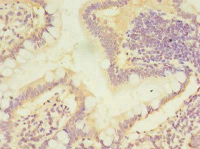 CMBL Antibody